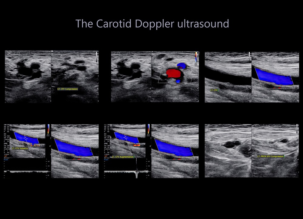 fertility pelvic scan