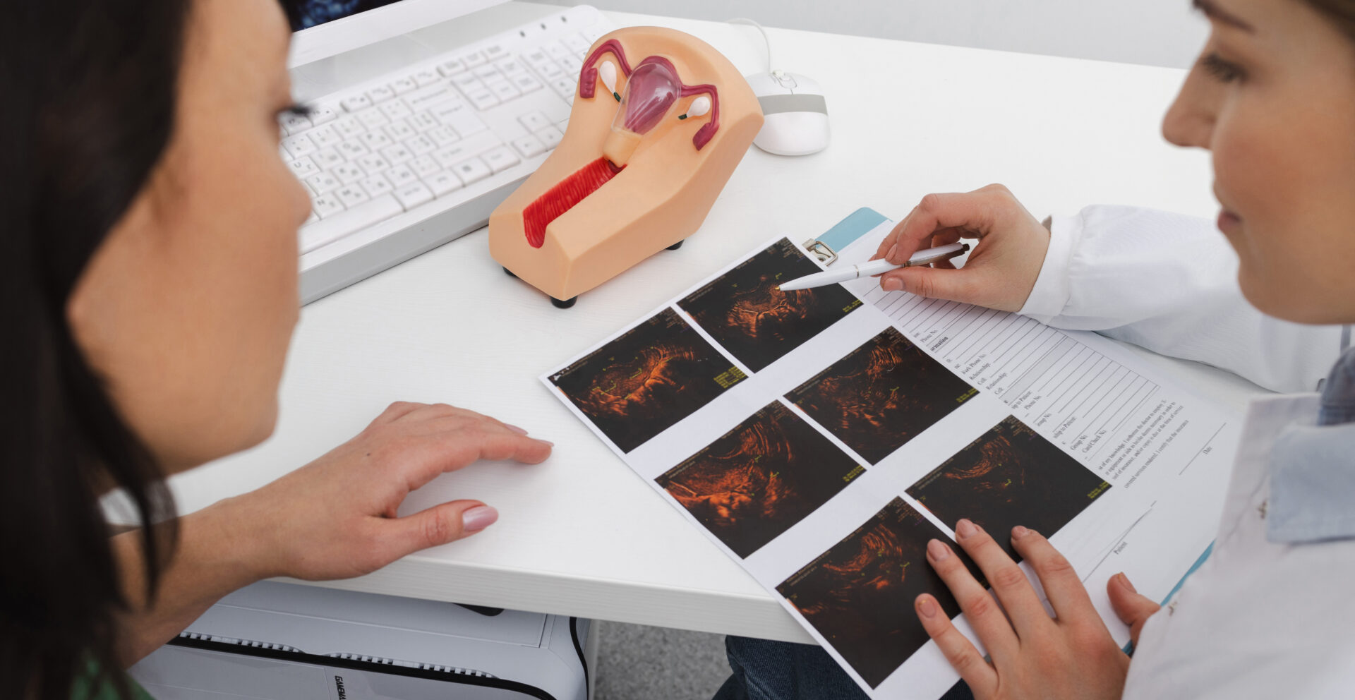 Follicular Tracking Scan (Per scan)